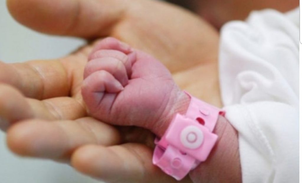 «Sono io il padre, no io…» Nasce una bambina e si presentano 3 papà