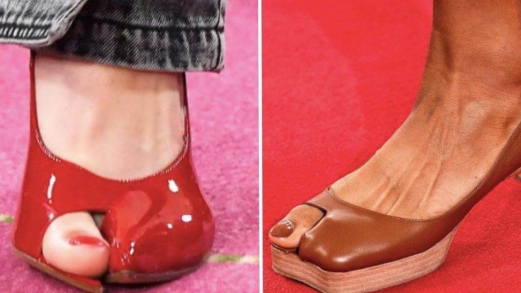 Le scarpe “alluci” sono l’ultima tendenza delle calzature