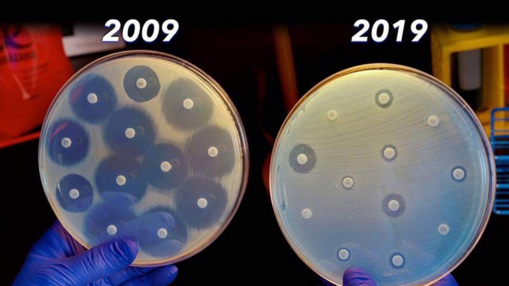 Antibiotici: l’unica #10yearChallenge di cui dovrebbe importarci