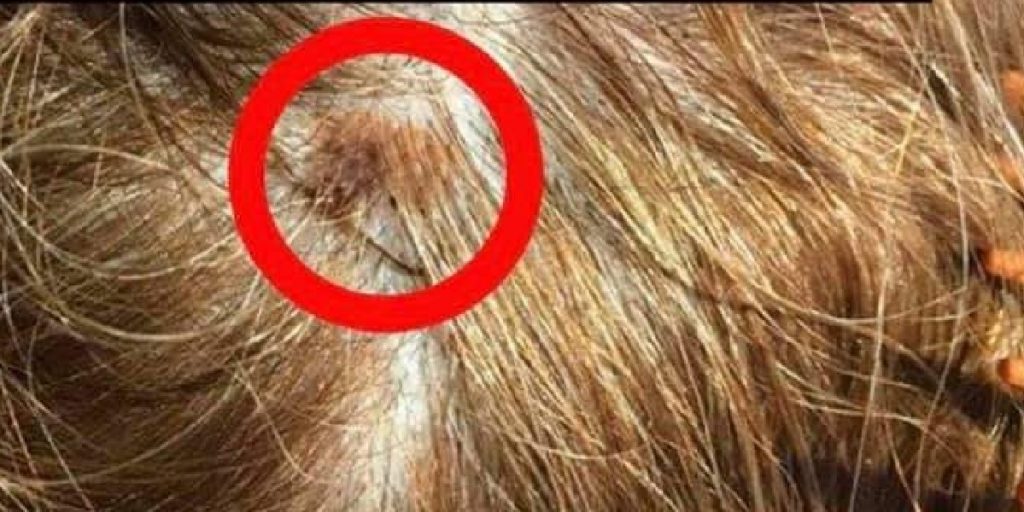 La parrucchiera nota una strana cosa tra i capelli e le fa una foto