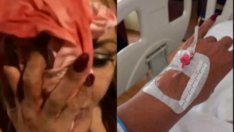 “L’hanno sfigurata”. L’amatissima attrice Italiana è stata aggredita, tagli sul volto e un fiume di sangue. [VIDEO]