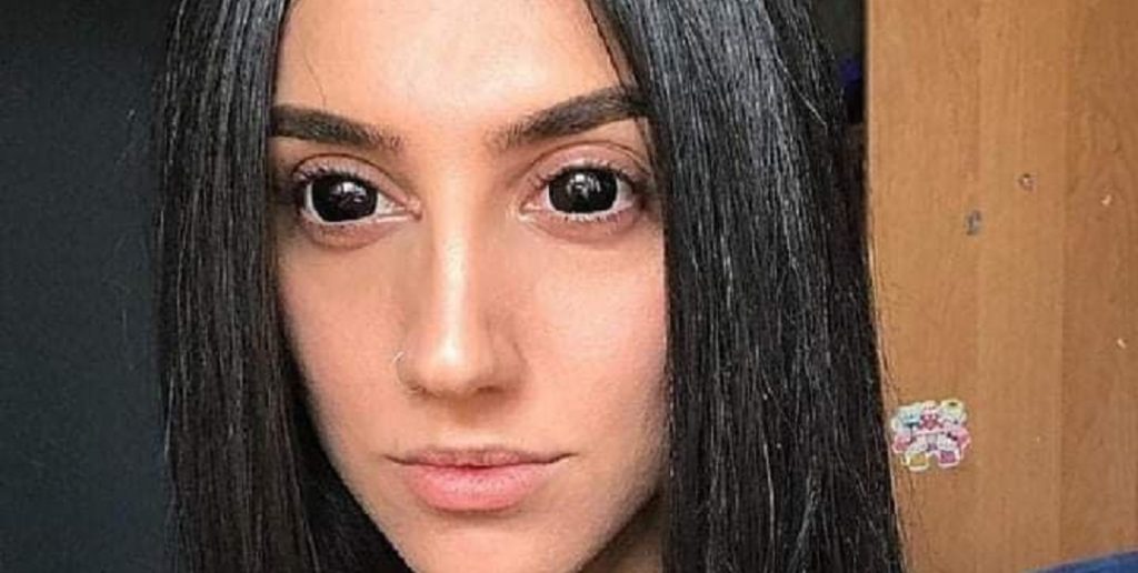 La ragazza chiamata da tutti “il diavolo”. Il motivo? Un fisico molto particolare.. (Foto)