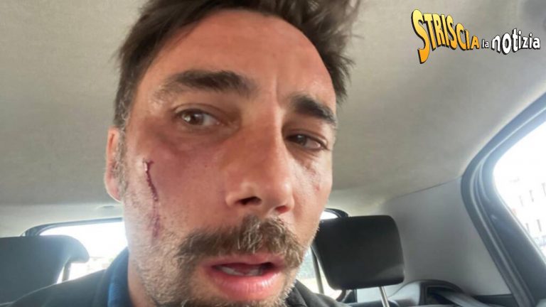 Vittorio Brumotti, aggressione choc: “La tua vita finisce”. Ecco chi c’è dietro le minacce. [VIDEO]