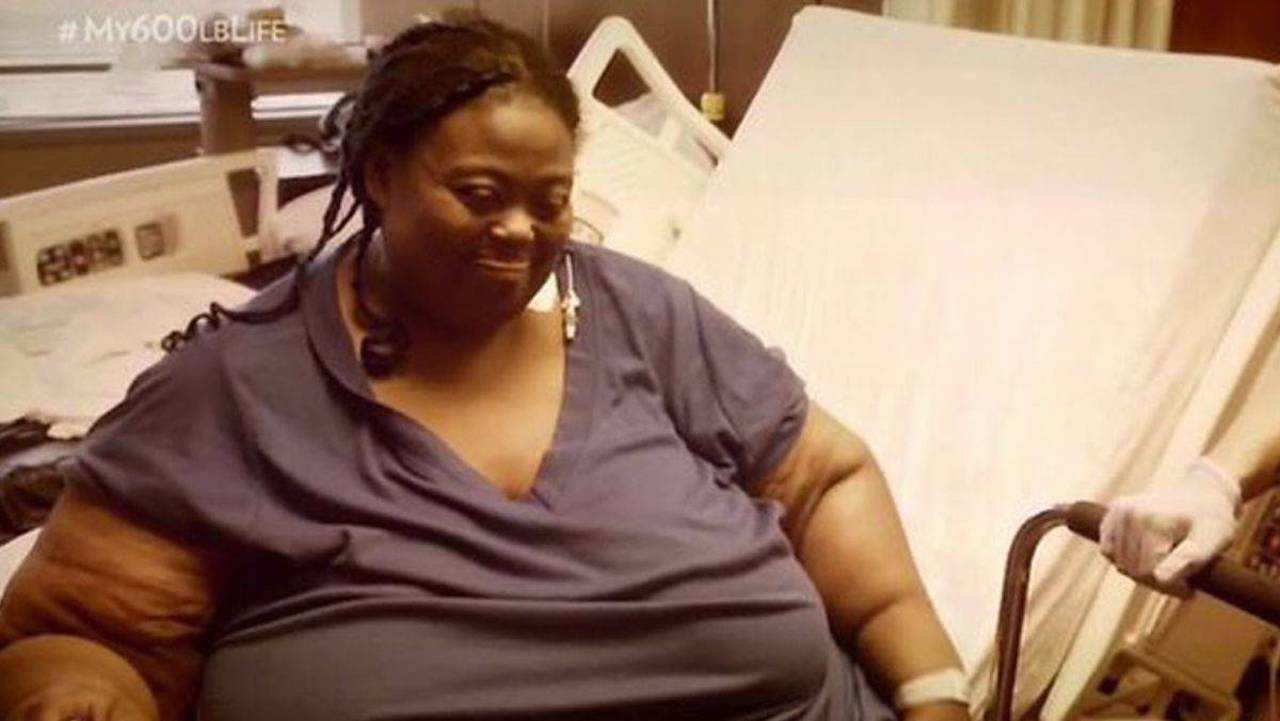 Vite al Limite, Marla McCants pesava 250 kg: la miracolosa trasformazione FOTO