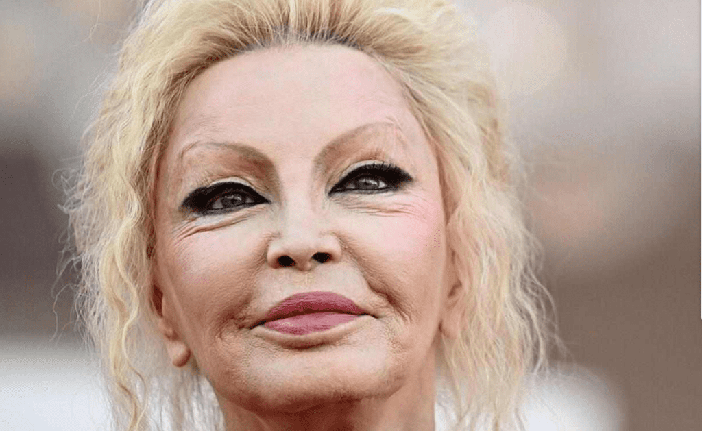 Patty Pravo, ma come si è ridotta? La verità sugli interventi | Il prima e il dopo