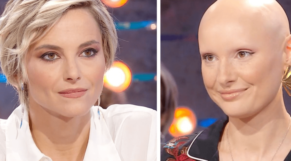 Sara Meucci, la modella affetta da tricotillomania  modella di fama  internazionale